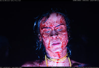 Sarcoma – Specka – 2025-04-12